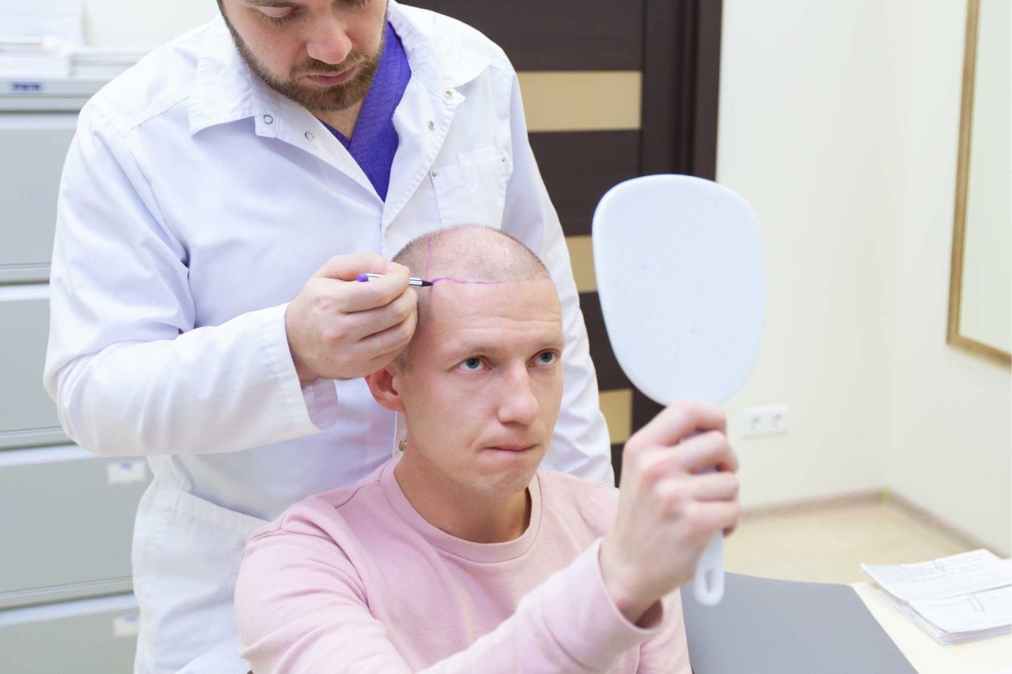 Hoe verhouden de kosten van een haartransplantatie in Nederland zich tot het buitenland?